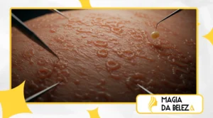 Psicodermatologia Como Suas Emoções Moldam Sua Pele