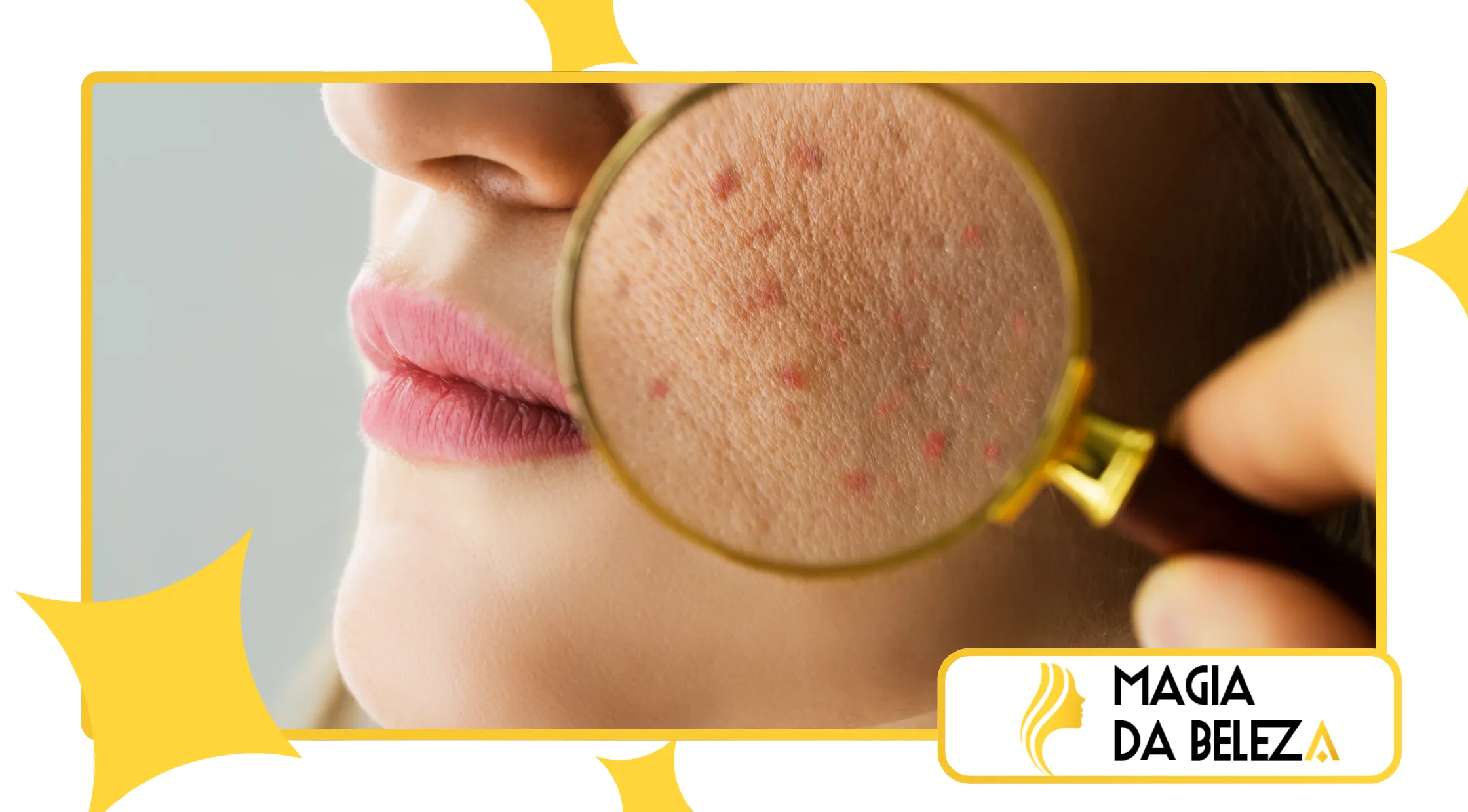 O que é skin barrier repair